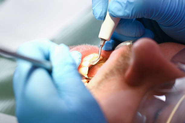 Best Emergency Dental Surgery in Arnold, CA