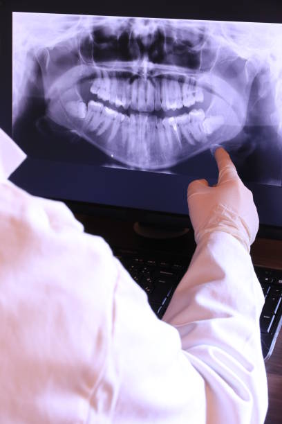 Best Emergency Treatment for Toothache in Arnold, CA