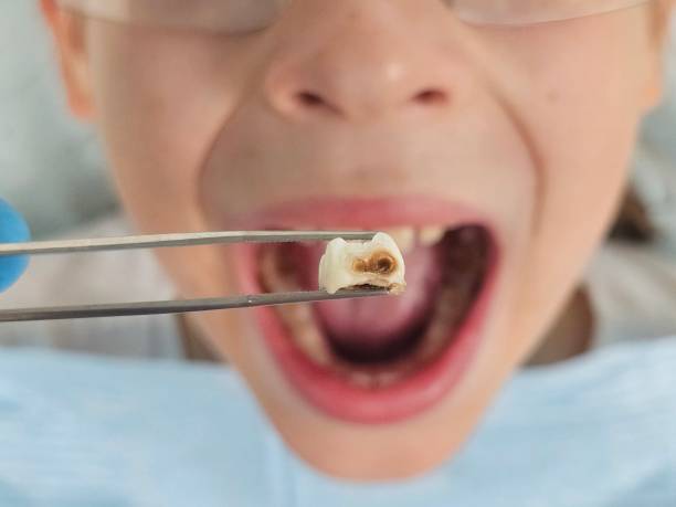Best Emergency Dental Care for Trauma or Injury in Arnold, CA